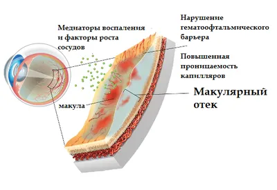 Как сетчатка распознаёт движение