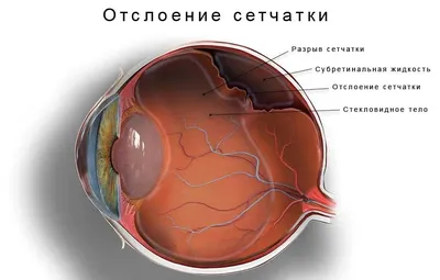 Когда нужно делать обследование сетчатки глаза