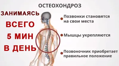 Как спать при шейном остеохондрозе