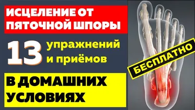 Лечение пяточной шпоры в Москве