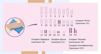 В Пермском крае бабушка и дедушка воспитывают внучку с синдромом Эдвардса,  мама которой умерла от рака  г -  - 