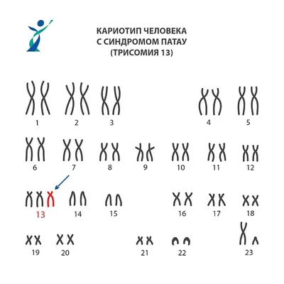 Только молока прибавилось, как Тата от нас ушла». Мама ребенка с синдромом  Эдвардса – о любви и потере | Правмир