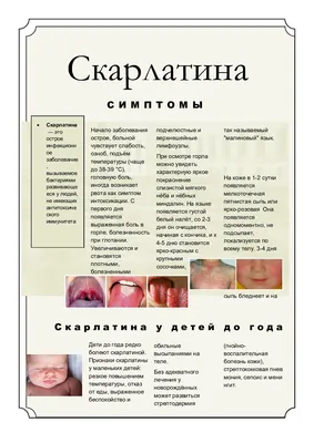 Скарлатина у детей: информация родителям - симптомы, диагностика и лечение