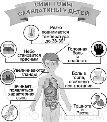 Скарлатина у детей. | Медицина. Педиатрия. Акушерство. | Дзен