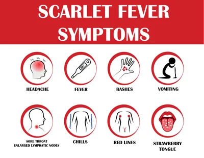 Скарлатина у детей: информация родителям - симптомы, диагностика и лечение