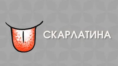 Скарлатина у взрослых: признаки, симптомы, диагностика, как передается,  лечение