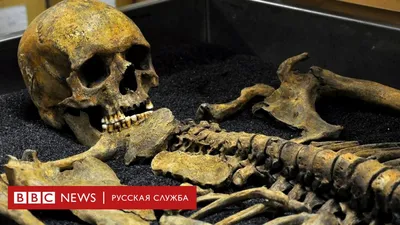 Лондонский музей, в подвалах которого лежат 20 000 скелетов - BBC News  Русская служба