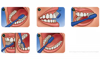 Клиника «Новая стоматология» советует: заведите привычку – правильно чистить  зубы