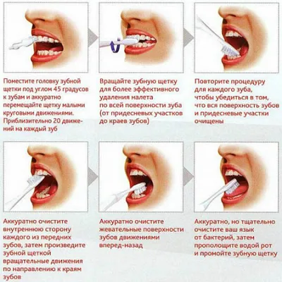 Как правильно чистить зубы?