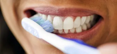 Чистка зубов в стоматологии – Цены в сети клиник в Санкт-Петербурге