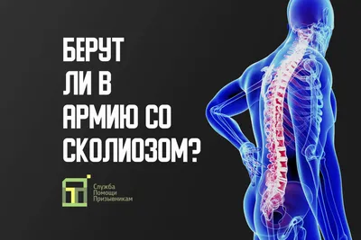 Берут ли в армию со сколиозом • ПризываНет