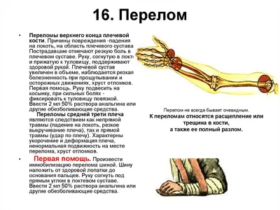 Сломанная рука. Причины и следствия