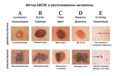 Наиболее уязвимые участки тела» - школа реального боя (18+)