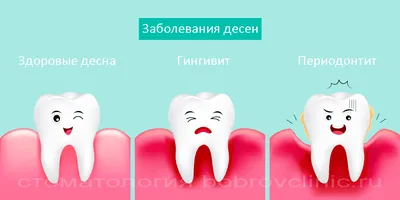 Когда зубная паста не очень качественная (3173) - Юмор в стиле  демотиваторов - фотогалерея - Профессиональный стоматологический портал  (сайт) «Клуб стоматологов»