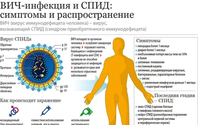 СПИД против COVID-19. В Нидерландах обнаружили новый агрессивный штамм -  РИА Новости, 