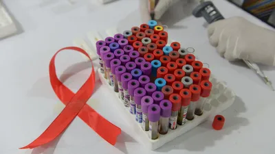ВИЧ и СПИД: 8 главных вопросов | РБК Стиль