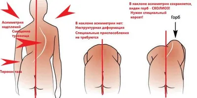 Как накачать красивую спину девушке — 4 эффективных упражнения в  тренажёрном зале - Чемпионат