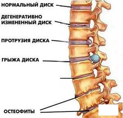 Мышцы спины в 3D. Анатомия спины человека. Обучение анатомии - YouTube