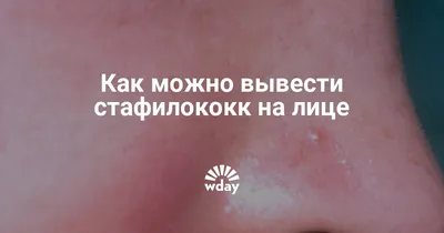 Фурункул, карбункул: диагностика и лечение в Киеве - Coolaser Clinic