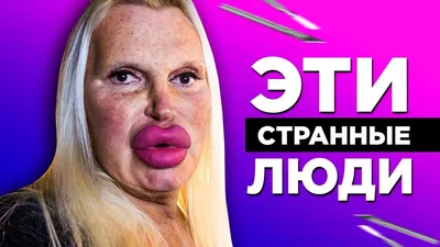 УЖАСЫ ПЛАСТИКИ. 80 000€ для достижения идеала - ЭТИ СТРАННЫЕ ЛЮДИ - YouTube