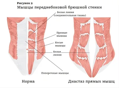 Брюшная и тазовая полости : нормальная анатомия | e-Anatomy