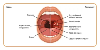 Анатомическая модель человеческого носа, горла, трахеи и cricopharyngeal |  AliExpress