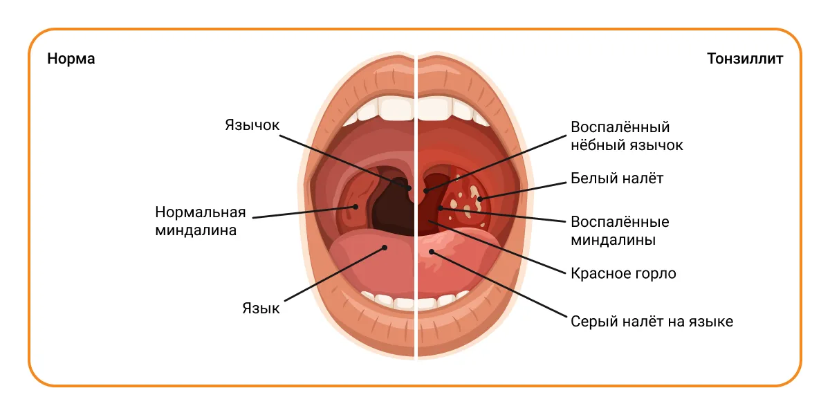 Строение небных миндалин