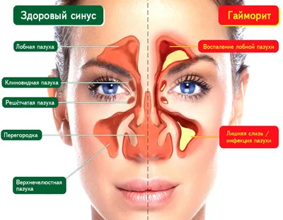 Как устроен нос, носовые пазухи | ВКонтакте