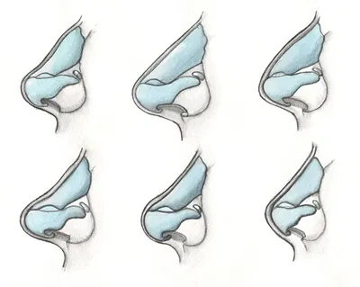 Анатомия носа и носовой перегородки | Александр Маркушин пластический хирург