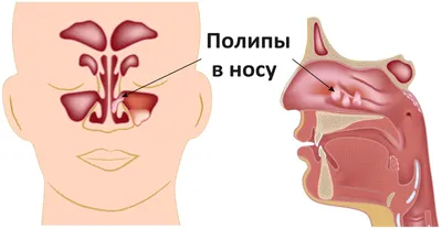 Рисунок деталей головы. Kак нарисовать нос человека? — Ghenadie Sontu Fine  Art