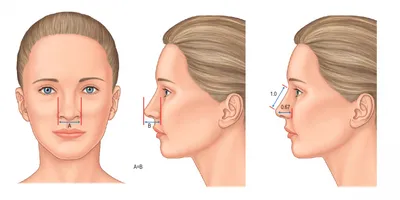 Анатомическая модель носа человека, модель патологии носа,  отоларинголология, модель человеческой носовой полости | AliExpress