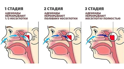 Нос человека: краткое руководство по строению и функциональным особенностям  - Блог проекта OMORFIA