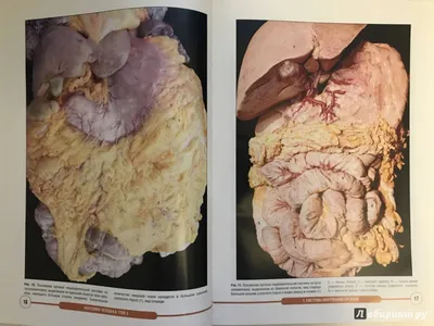 Анатомия человека: атлас В 3 т. Т. 2: Внутренние органы - купить с  доставкой по выгодным ценам в интернет-магазине OZON (1034677039)