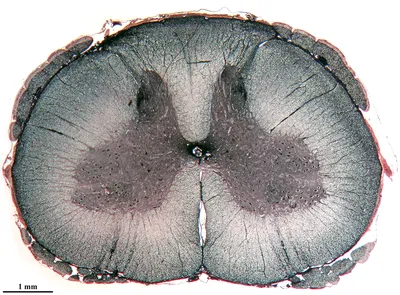 Строение спинного мозга картинки