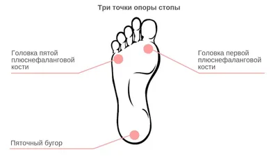 Отличия вальгусной деформации стопы у мужчин и женщин