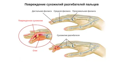 Кисть (анатомия) — Википедия