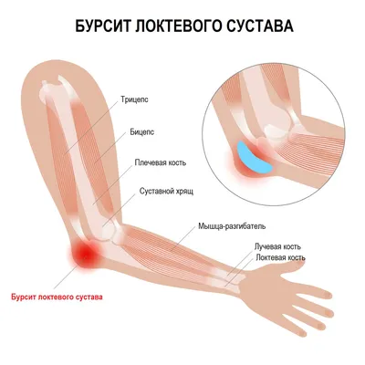 Основные повреждения связок кисти | Герммед