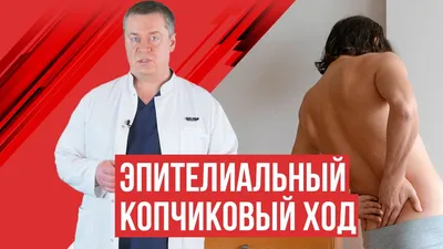 Киста копчика или фурункул: причины, симптомы и лечение