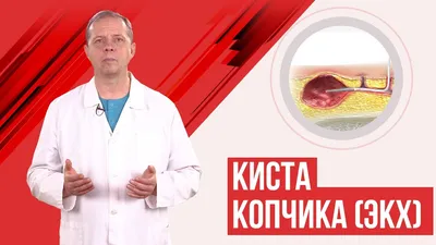 Лечение ЭКХ - операция по иссечению в клинике колопроктологии в Москве