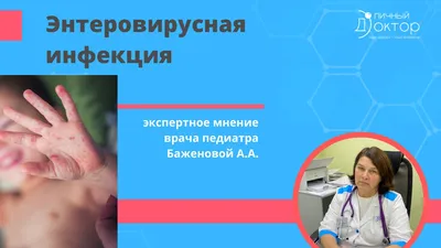 О профилактике энтеровирусной инфекции