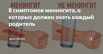 Симптомы менингококковой инфекции, советы врача чем опасен и как распознать  менингококк -  - НГС.ру