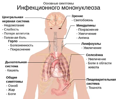 Мононуклеоз: что это, симптомы у детей, признаки, лечение, как передается,  последствия