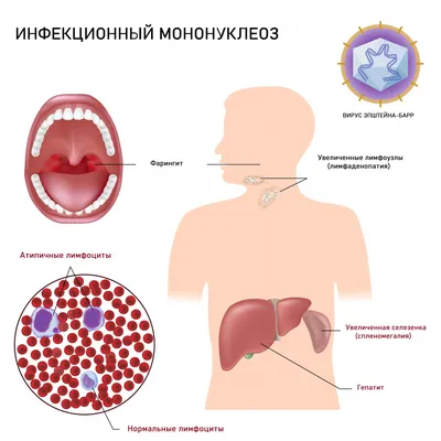 На что похожа сыпь? - Вопросы о детях - BabyPlan