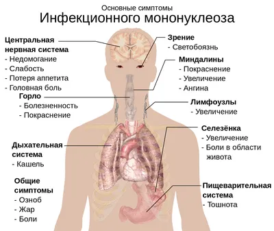 Сыпь по всему телу. — 16 ответов | форум Babyblog