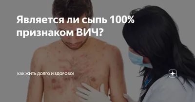 Является ли сыпь 100% признаком ВИЧ? | Как жить долго и здОрОво! | Дзен