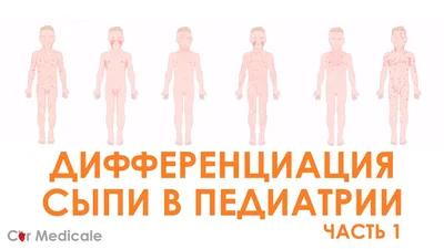 Угревая сыпь (акне) – причины, симптомы, диагностика, профилактика и  лечение | Врачи Онлайн