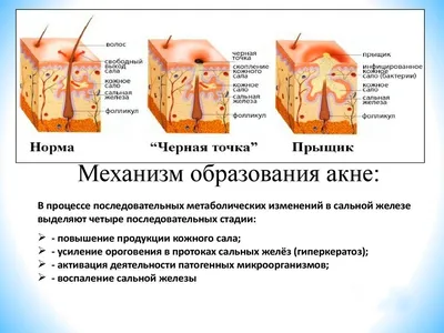 Сыпь на теле - причины, симптомы и лечение высыпаний на коже | Mriya Med