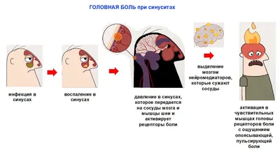 Типы головных болей и причины их появления