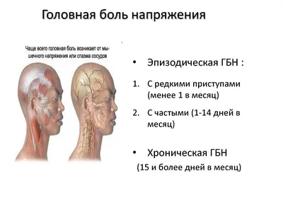 Головная боль ✅️: причины, симптомы и лечение сильной, частой и постоянной головной  боли