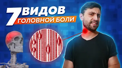 Таблетки от головной боли: виды, как действуют, как выбрать?